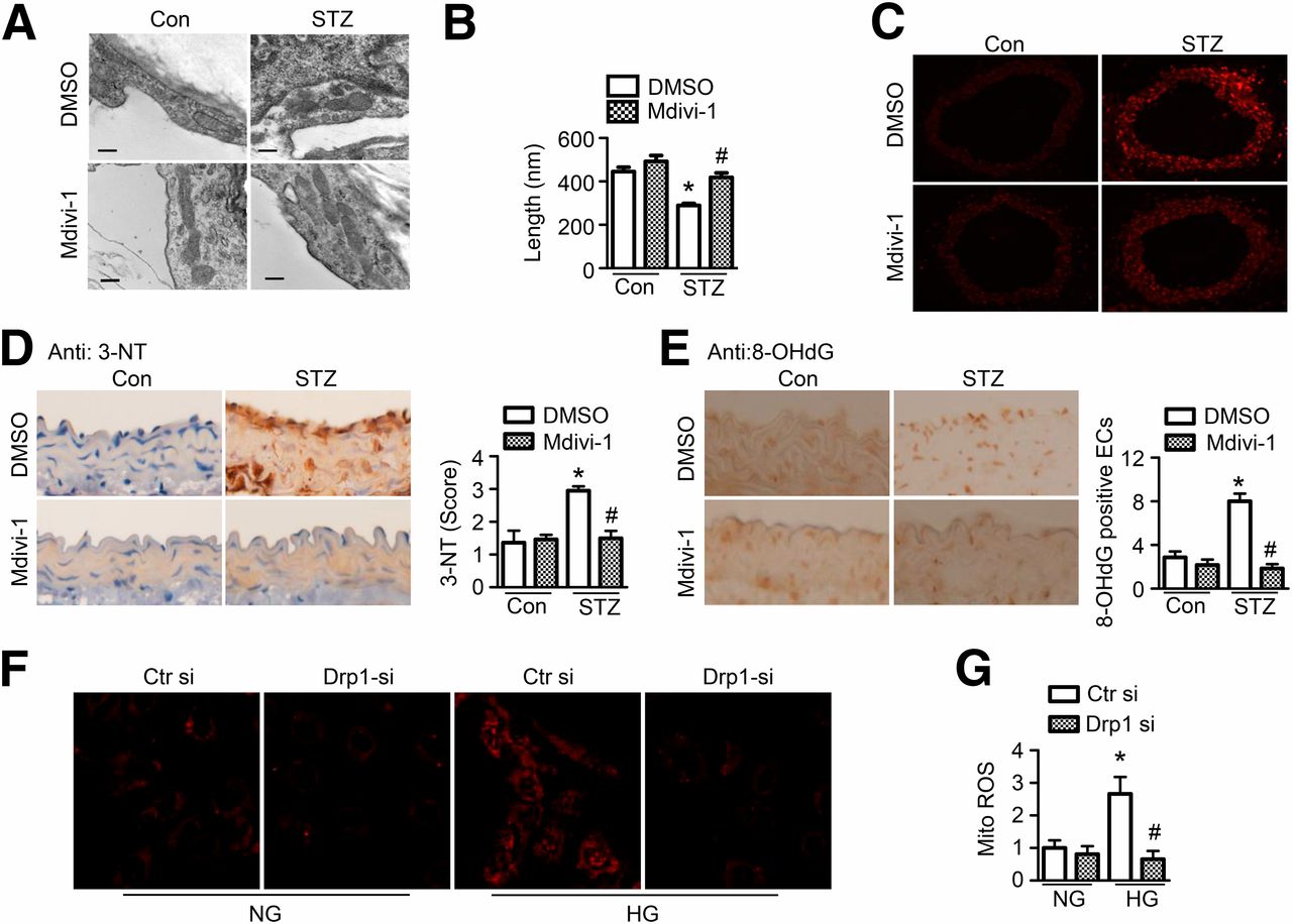 metformin suppresses diabetes accelerated