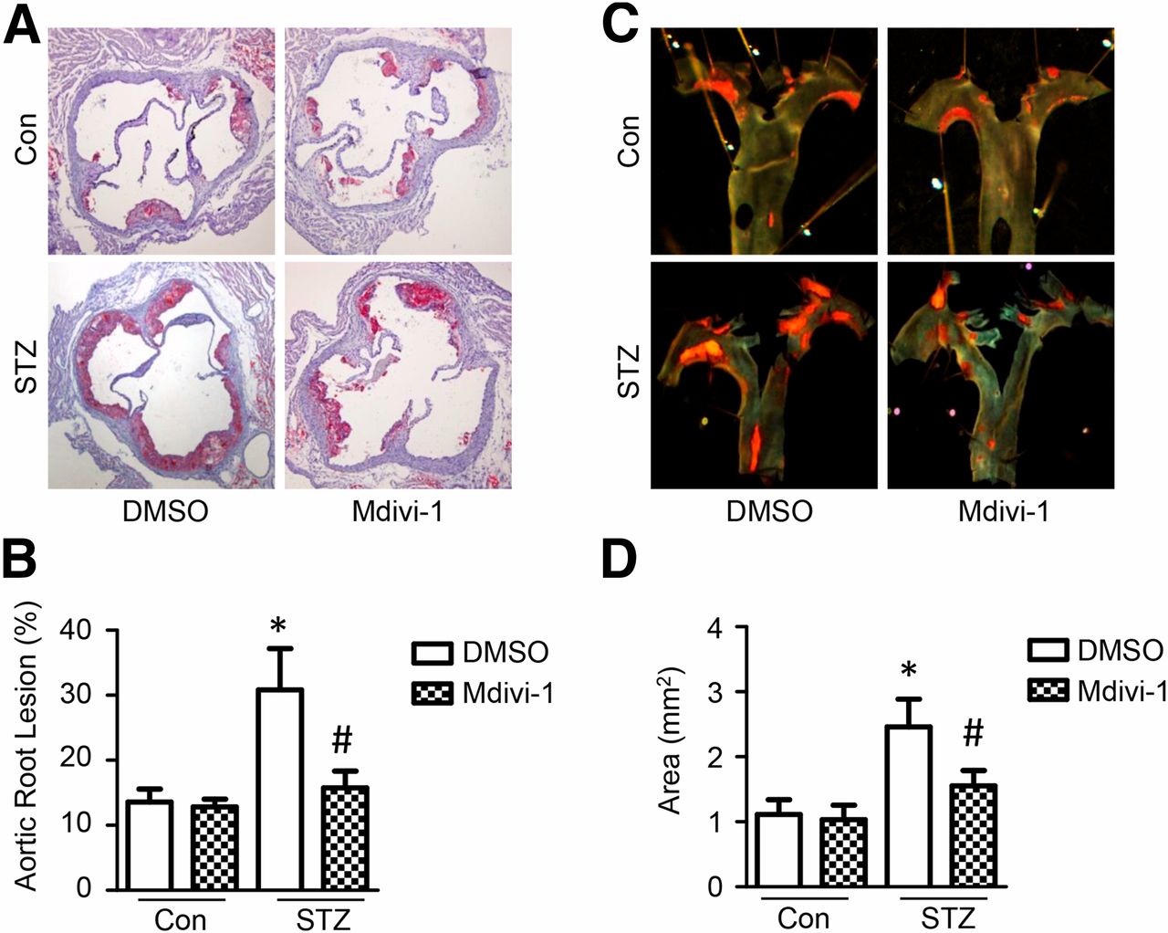 metformin suppresses diabetes accelerated